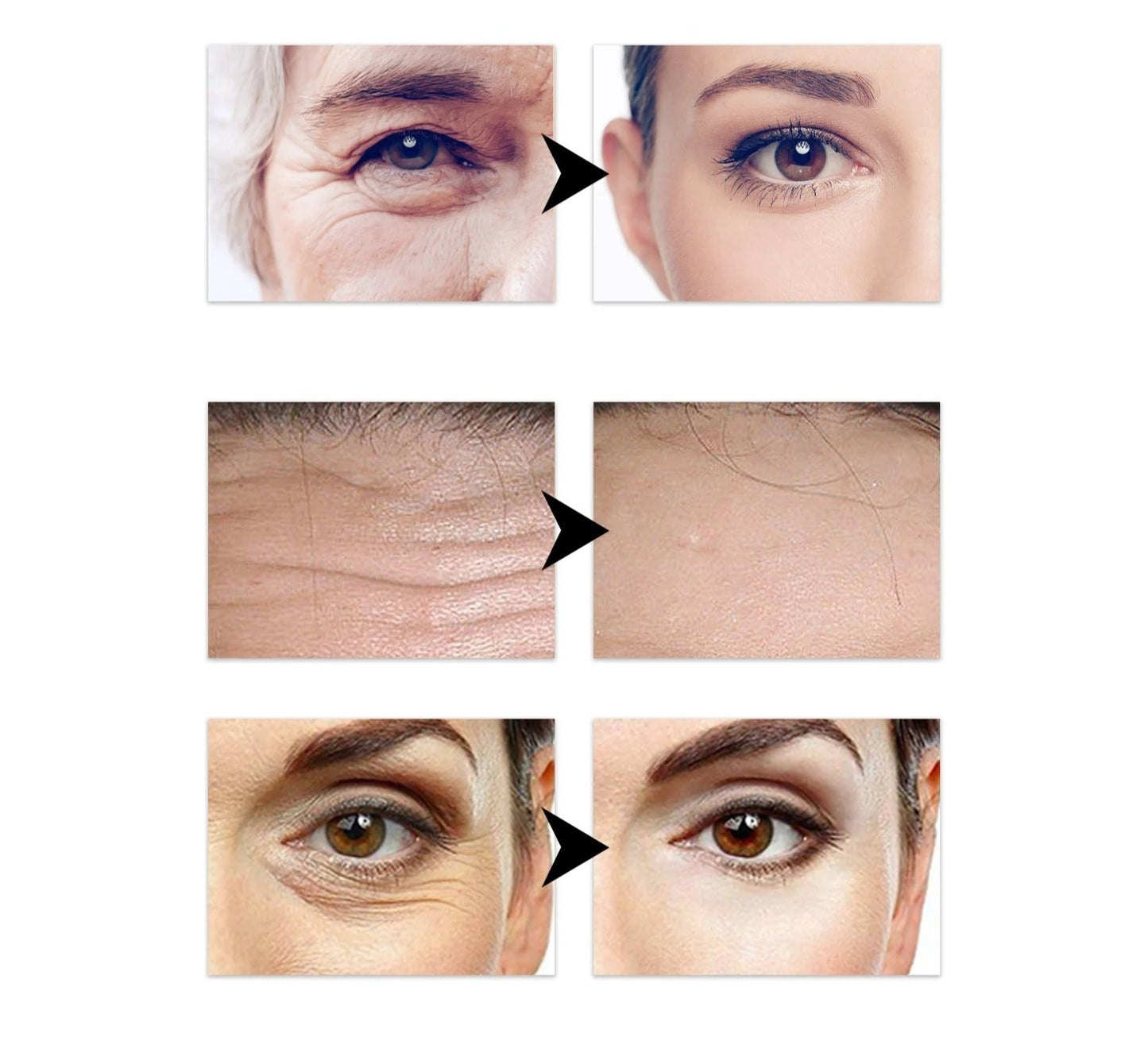 Instant-effect Collagen Patches