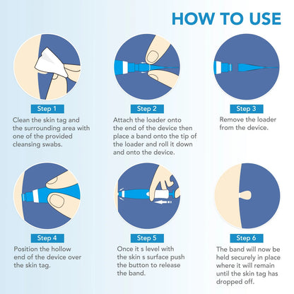 Skin Tag Removal Kit